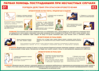 Таблица "Порядок действий при опасном кровотечении" (100х140 сантиметров, винил) - fgospostavki.ru - Нижний Новгород