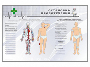 Электрифицированный стенд "Остановка кровотечения" - fgospostavki.ru - Нижний Новгород
